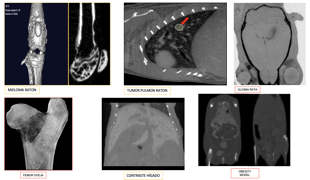 Microtomografia computada