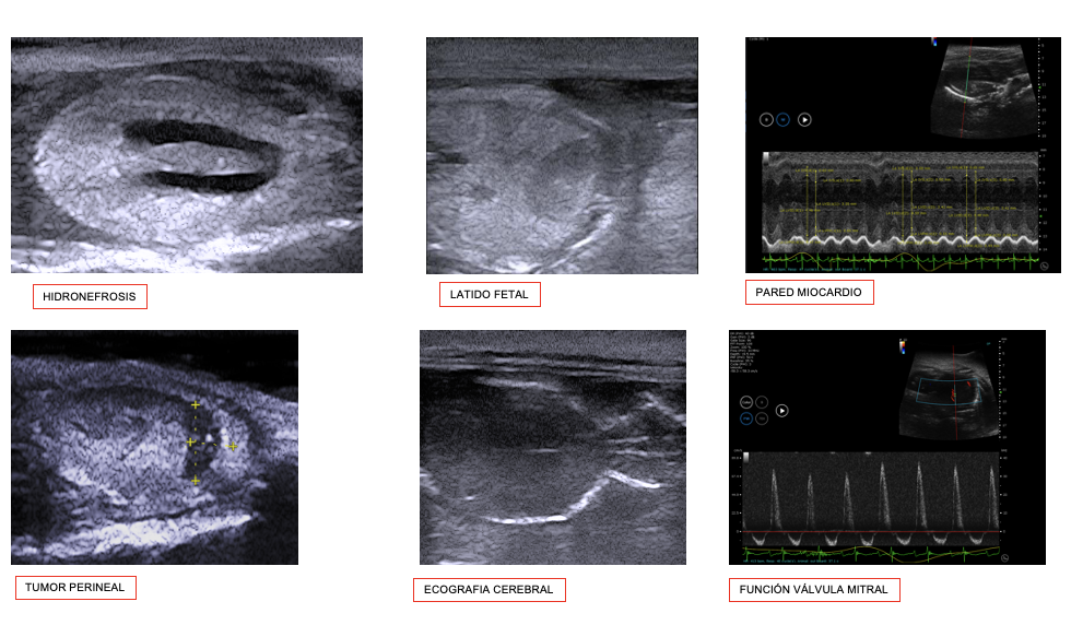 Ultrasons d'alta freqüència