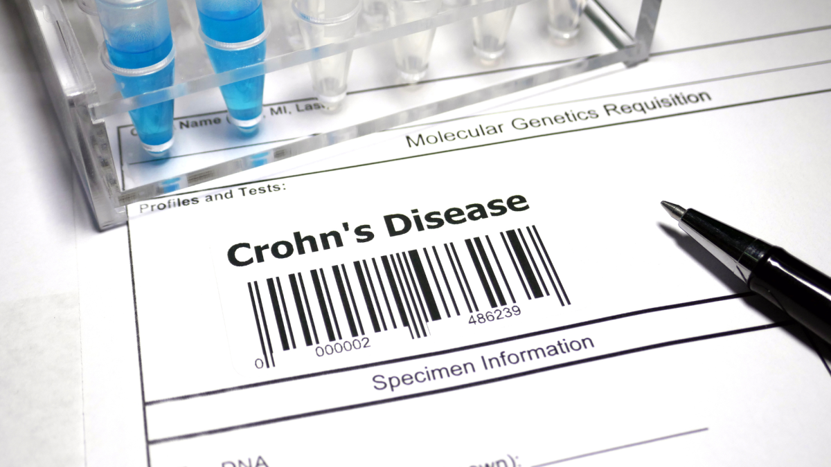 Malaltia de Crohn