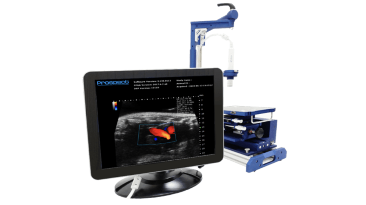 Ultrasons d’alta freqüència: Ecografia Prospect 1