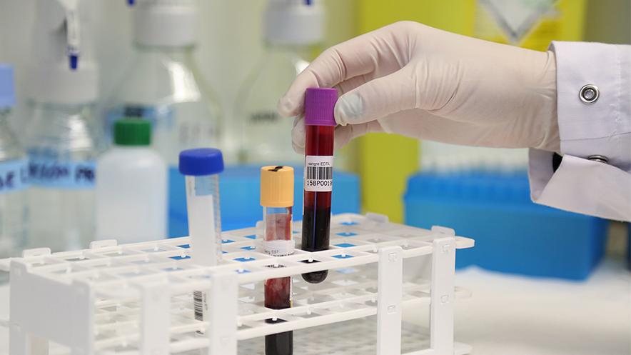 biobanc_idp_808