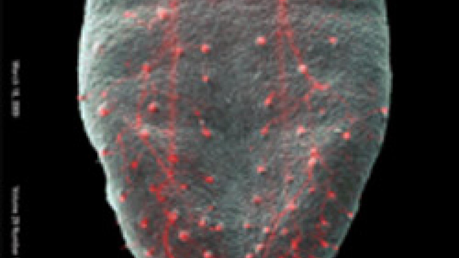 2010_0085_2010_0085_IMATGE