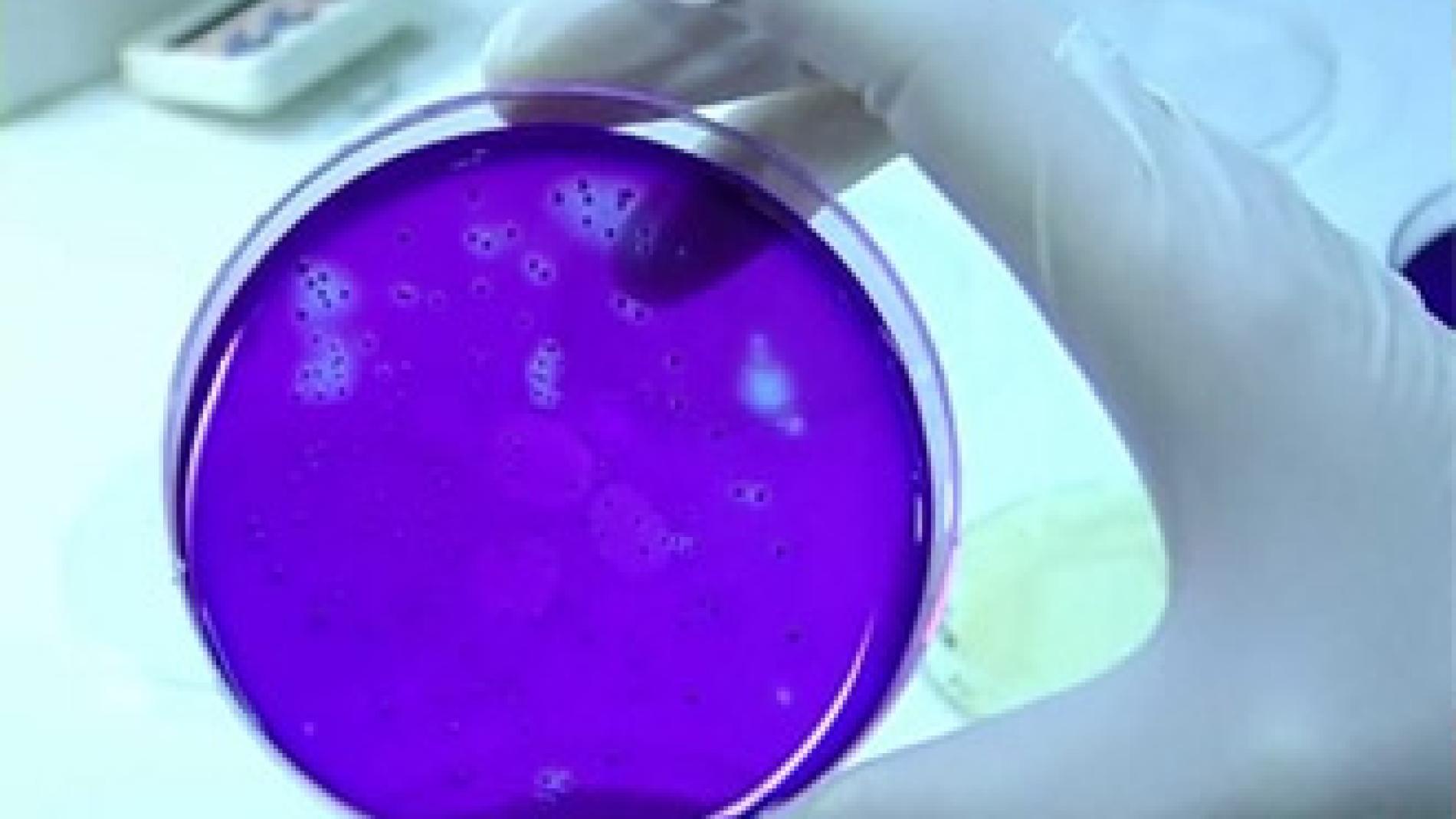 2010_0151_2010_0151_IMATGE