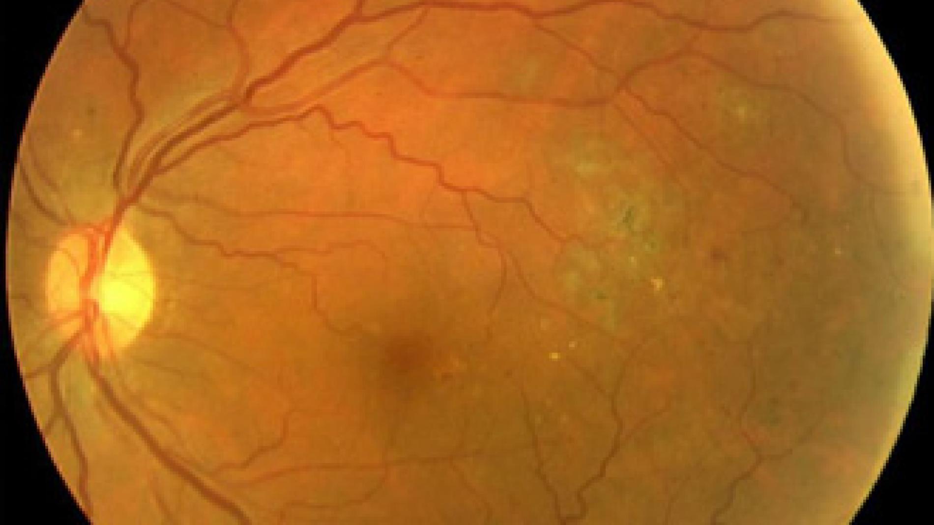 2011_0095_2011_0095_IMATGE