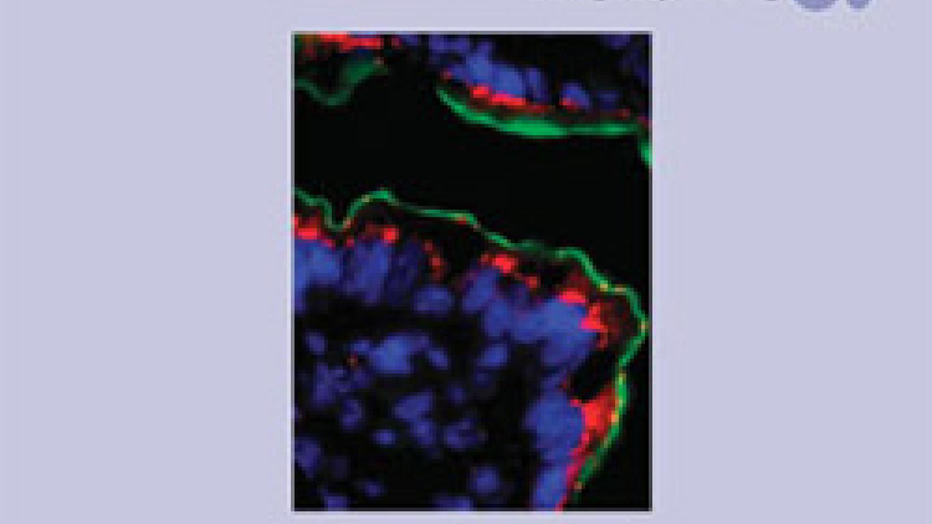 2011_0162_2011_0162_IMATGE