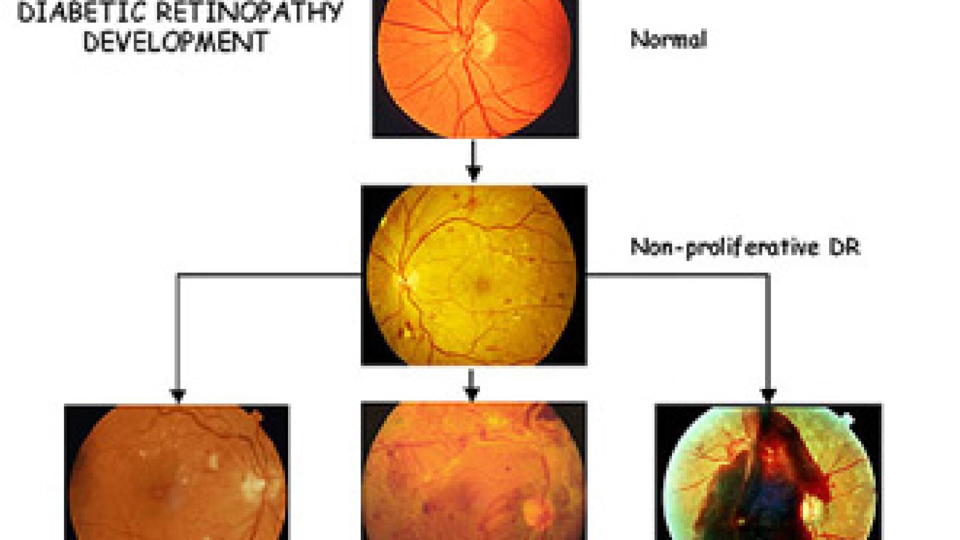 2011_0176_2011_0176_IMATGE