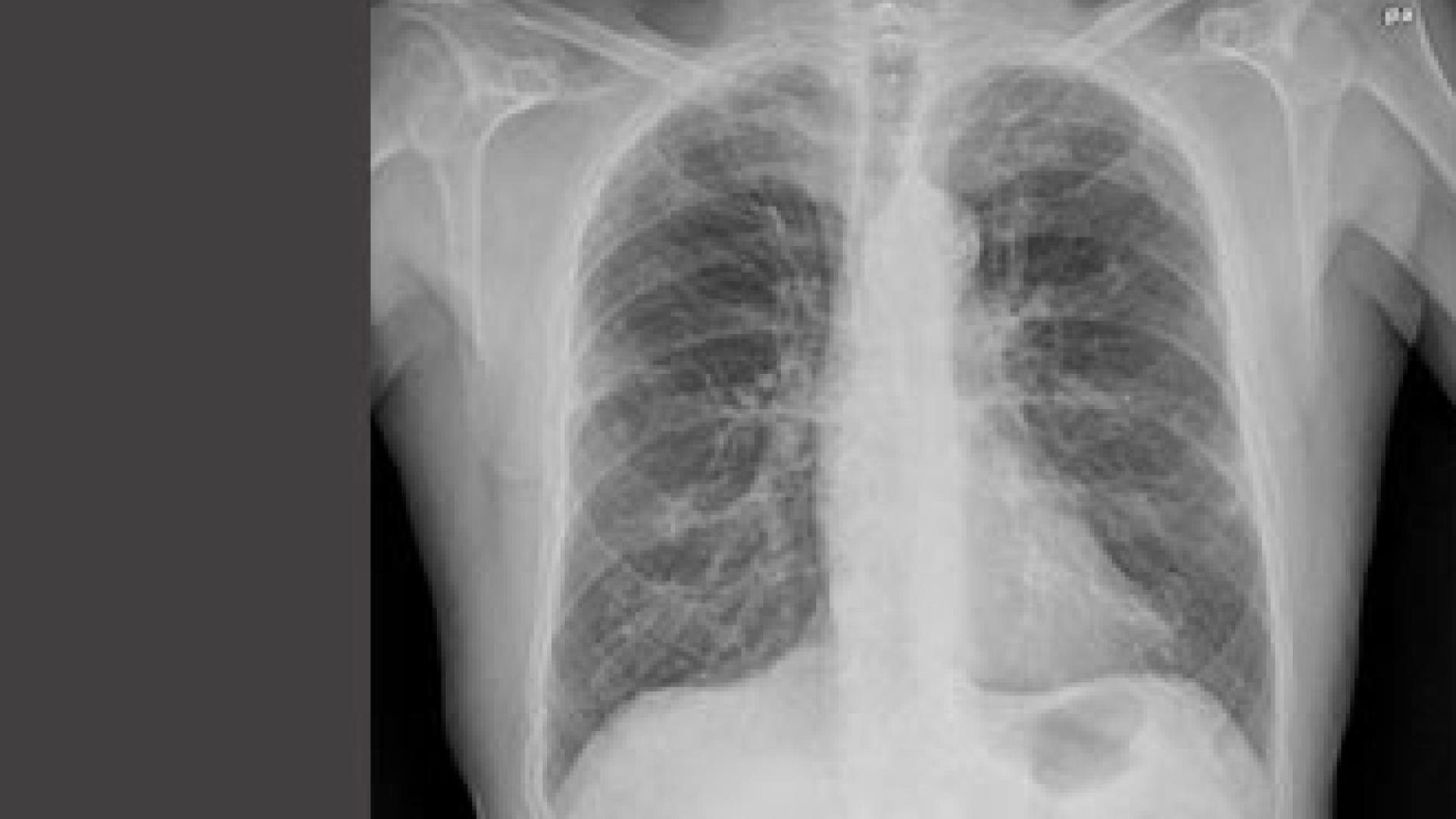 2011_0237_2011_0237_IMATGE