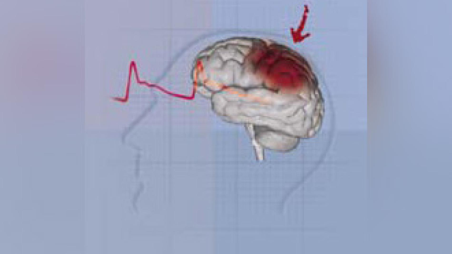 2012_0037_2012_0037_IMATGE