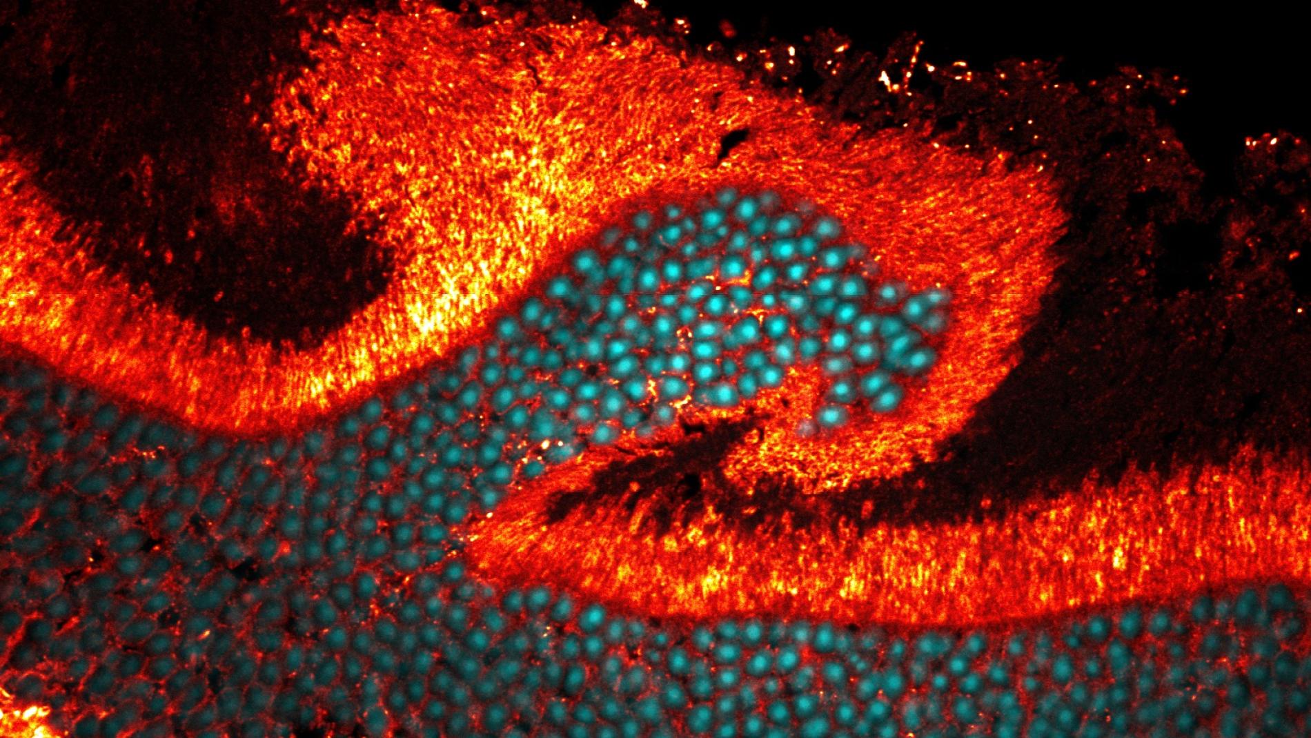 Magma retinal Patricia Bogdanov