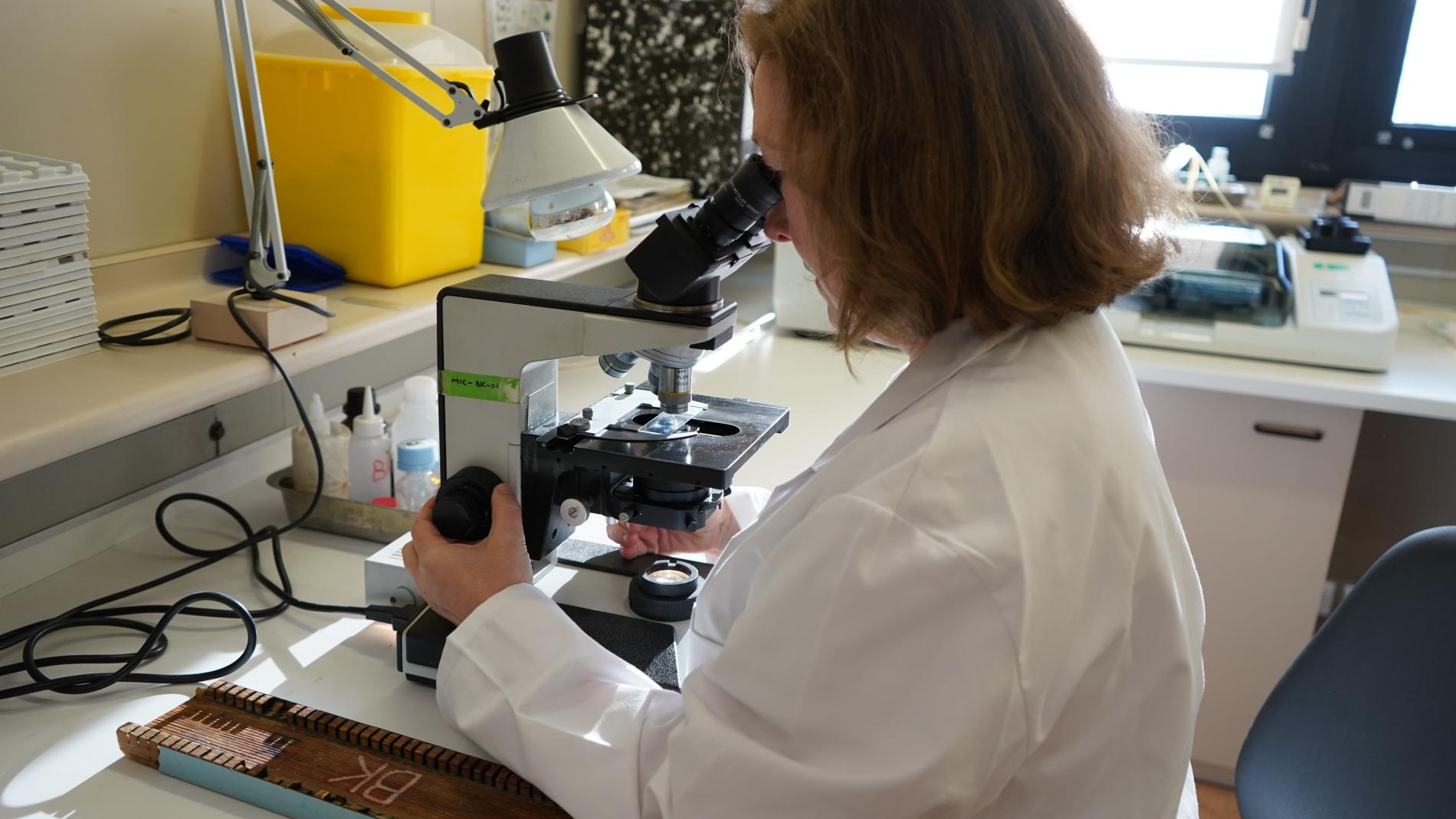 Mostra de tuberculosi al microscopi.