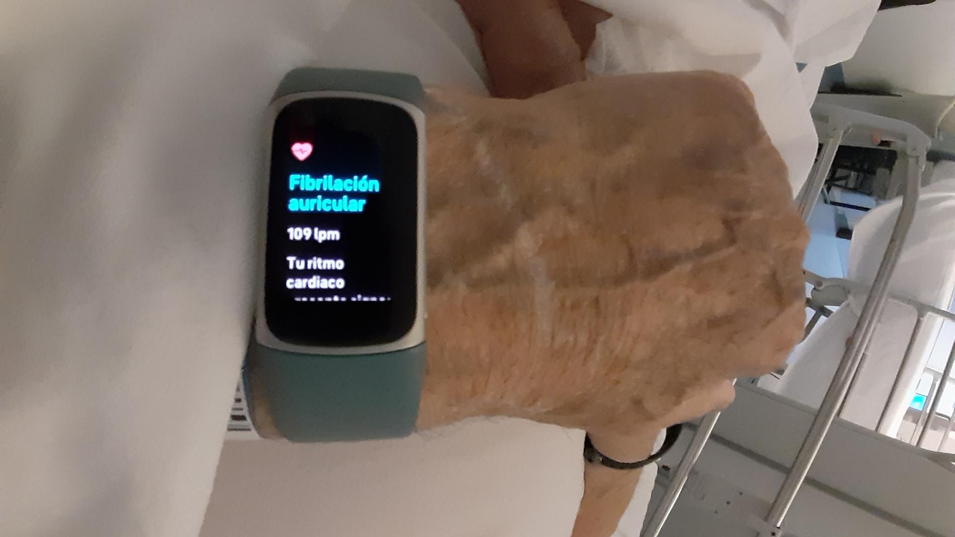 Alerta de fibril·lació auricular