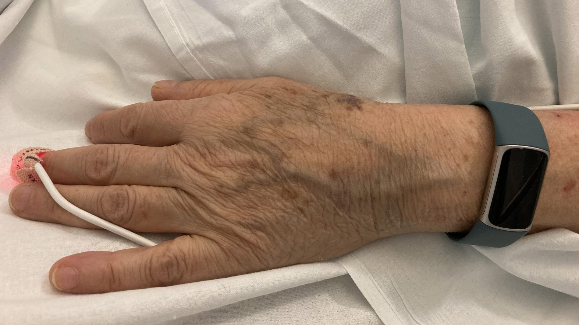 Pacient amb rellotge intel·ligent