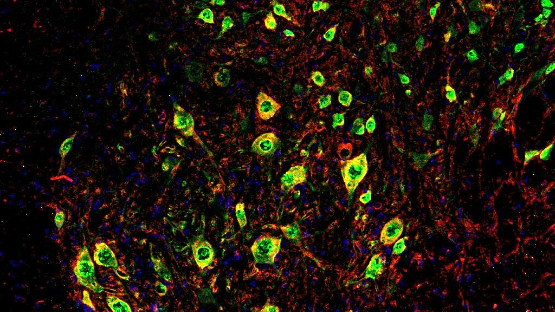 Motoneurones de la medul·la espinal