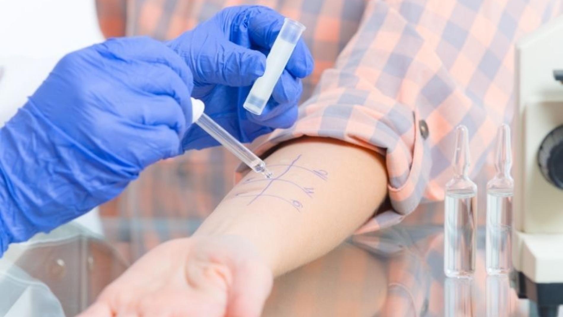 Servei Al·lergologia