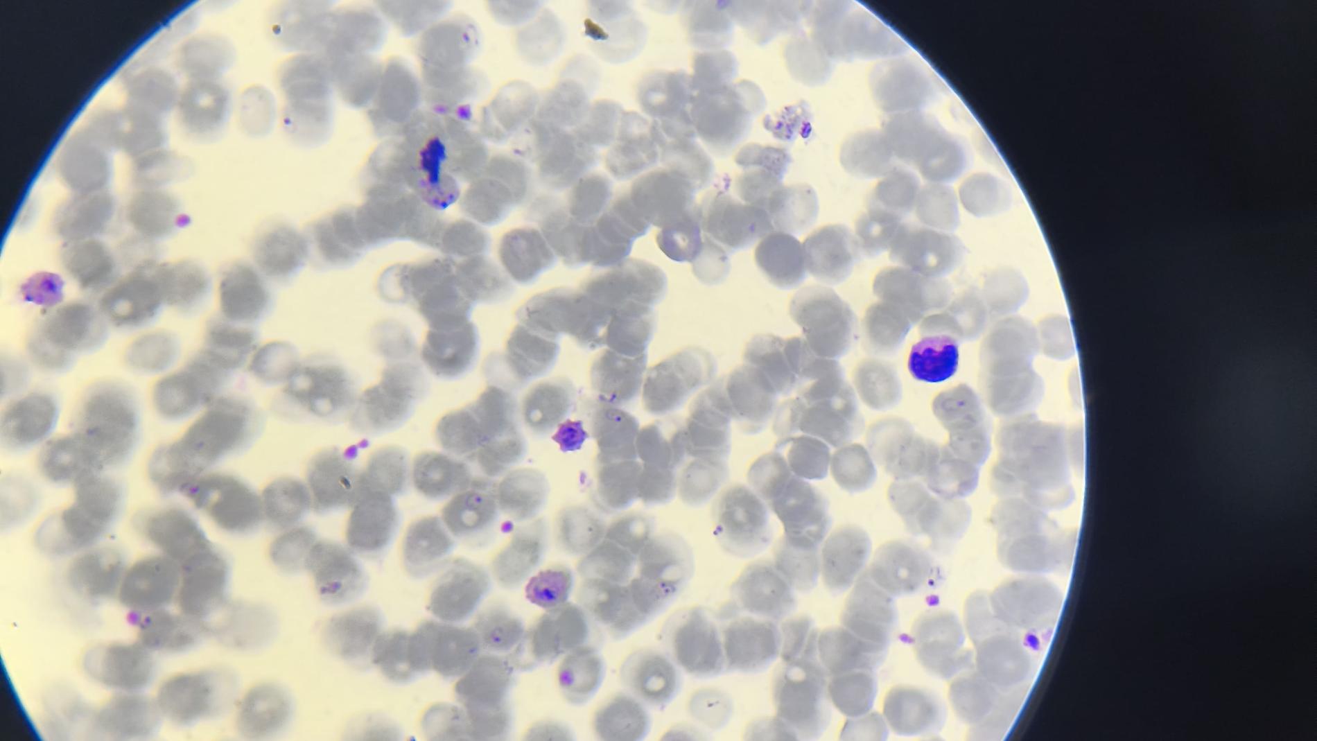 Investigación de la enfermedad