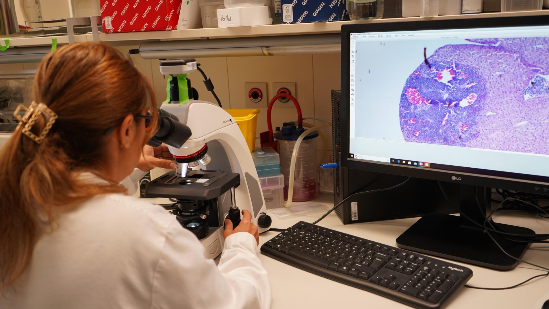 Imatge de neuroblastoma al microscopi
