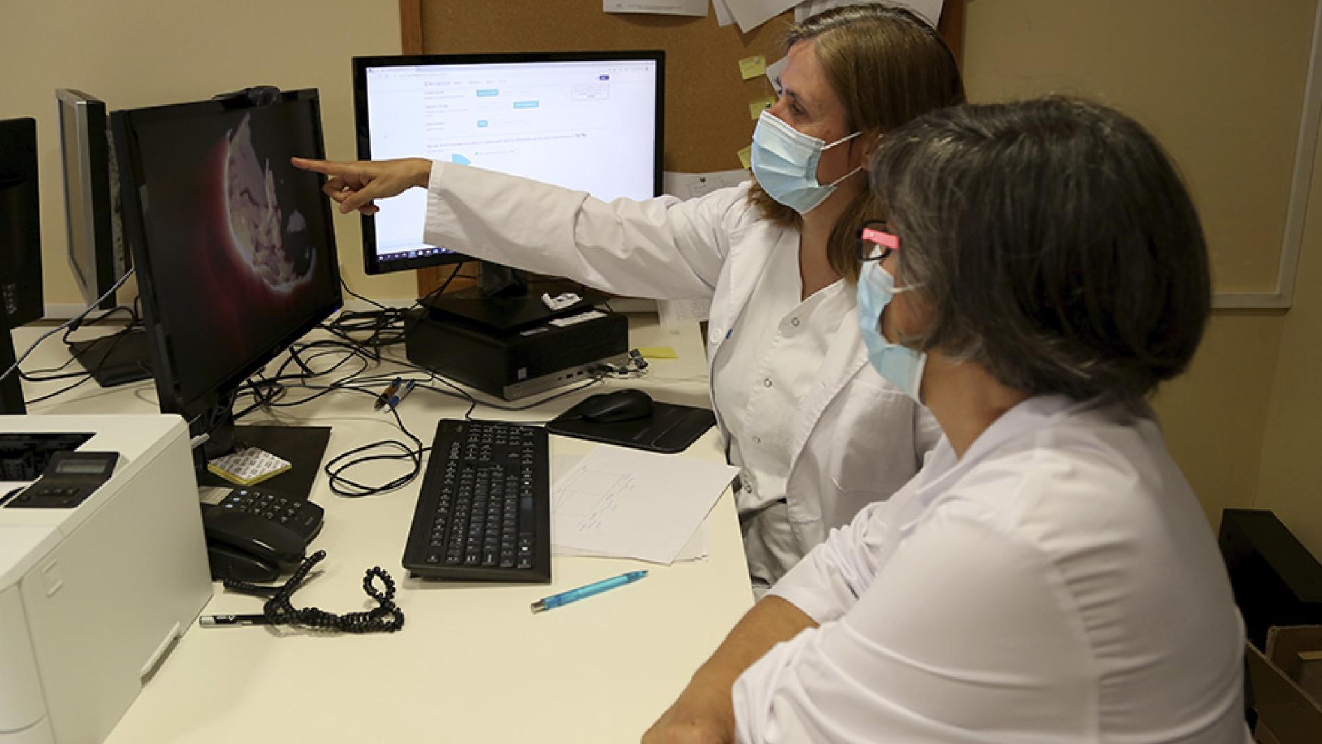 calculadora-endocarditis-8841